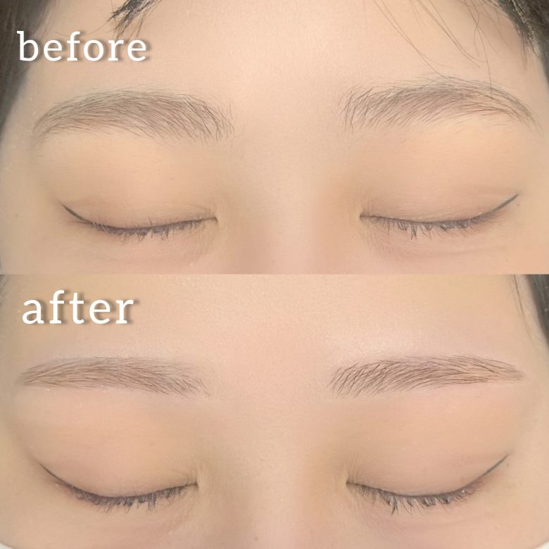 霧島国分店のお客様の 眉 毛ワックスbefore afterの写真です