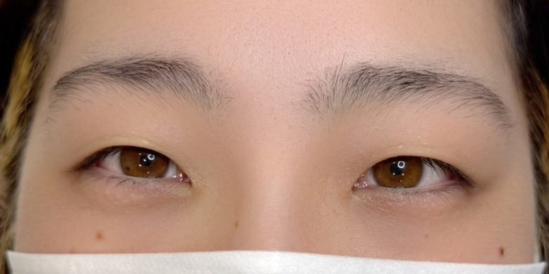 眉毛ワックス×まつ毛パーマセットのビフォー写真