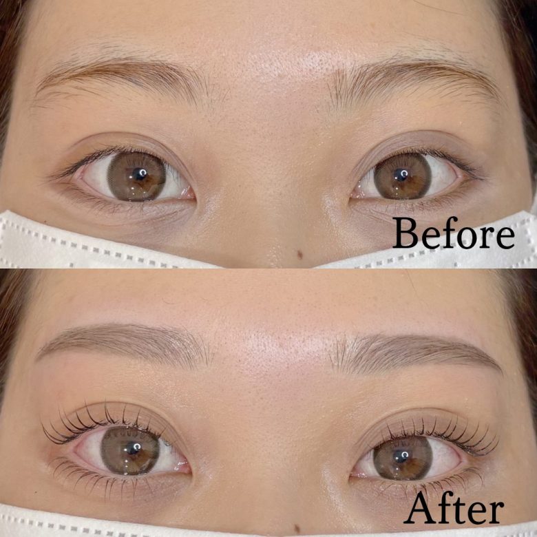 記事のサムネイル